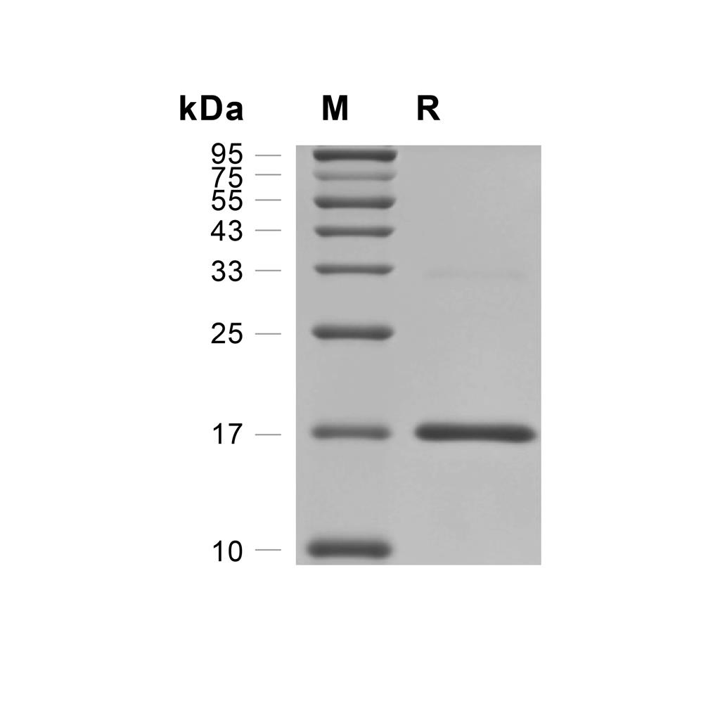 HBP1蛋白, Human (His),HBP1 Protein, Human (His)