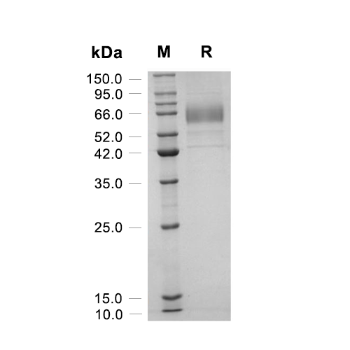 Fc epsilon RIA/FCER1A蛋白, Mouse (HEK293, Fc),Fc epsilon RIA/FCER1A Protein, Mouse (HEK293, Fc)