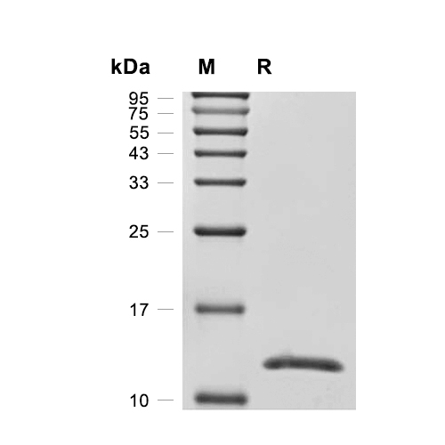 FABP3蛋白, Mouse,FABP3 Protein, Mouse