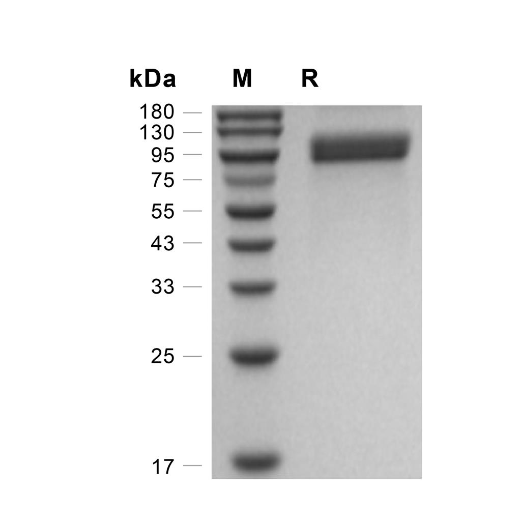 E-selectin/CD62E蛋白, Cynomolgus (HEK293, His),E-selectin/CD62E Protein, Cynomolgus (HEK293, His)