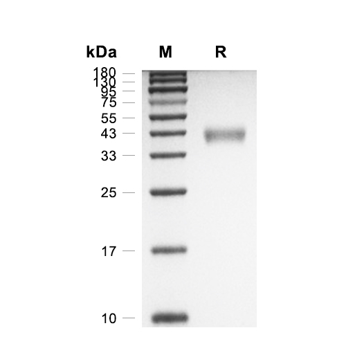 CD52蛋白, Mouse (HEK293, Fc),CD52 Protein, Mouse (HEK293, Fc)