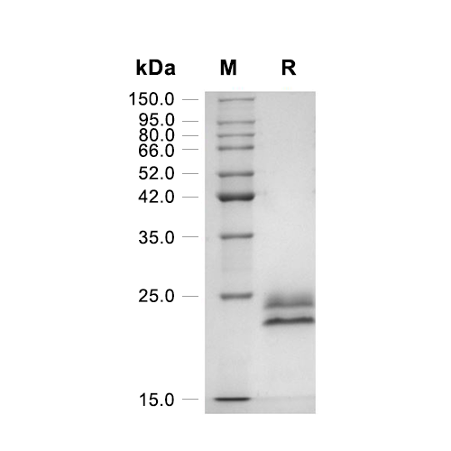 CD20/MS4A1蛋白, Cynomolgus (85a.a, HEK293, His),CD20/MS4A1 Protein, Cynomolgus (85a.a, HEK293, His)