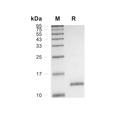 COX5B蛋白, Human (His),COX5B Protein, Human (His)