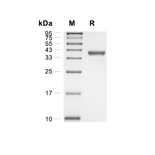 JTB蛋白, Human (HEK293, Fc),JTB Protein, Human (HEK293, Fc)