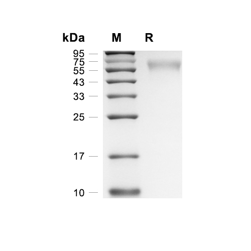NRXN3/Neurexin-3蛋白, Human (HEK293, His),NRXN3/Neurexin-3 Protein, Human (HEK293, His)