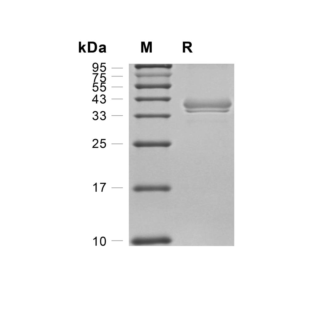 BCMA/TNFRSF17蛋白, Rhesus Macaque (HEK293, Fc),BCMA/TNFRSF17 Protein, Rhesus Macaque (HEK293, Fc)
