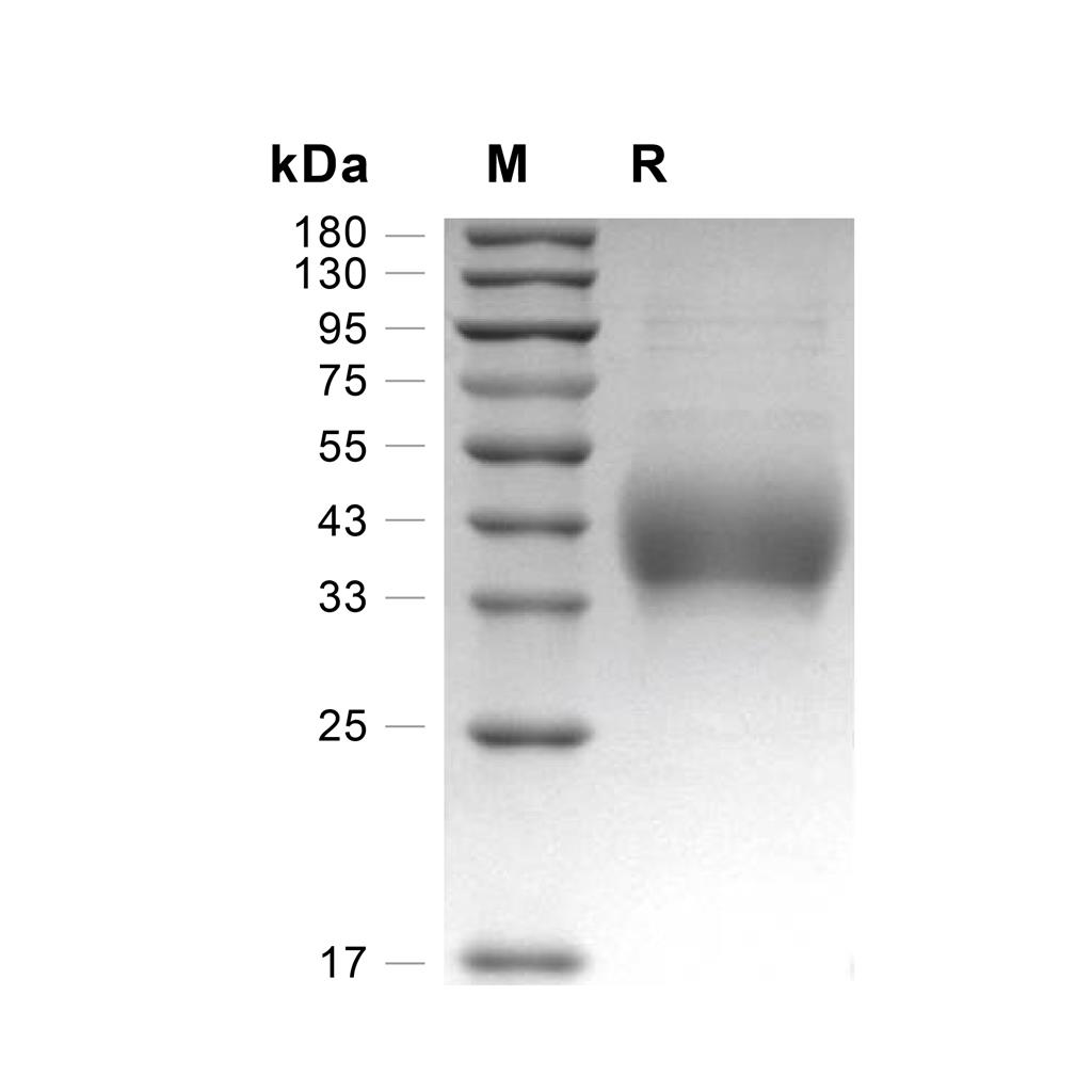 DNAM-1蛋白, Rat (HEK293, His),DNAM-1 Protein, Rat (HEK293, His)