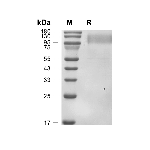 envelope glycoprotein gp120蛋白, HIV-1 (AAC31819, HEK293, His),envelope glycoprotein gp120 Protein, HIV-1 (AAC31819, HEK293, His)
