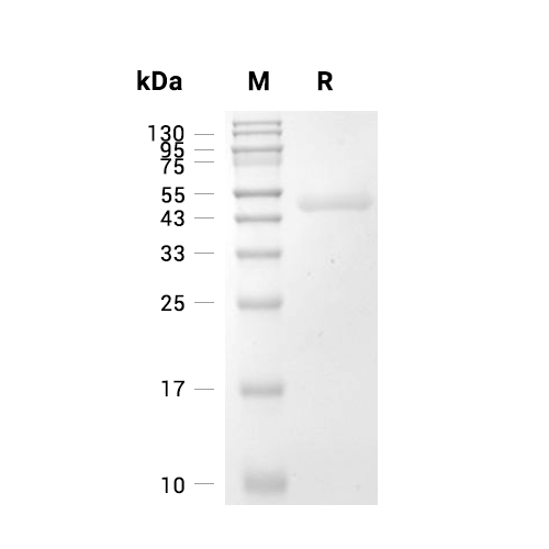 LRPAP1蛋白, Mouse (HEK293, His, Solution),LRPAP1 Protein, Mouse (HEK293, His, Solution)