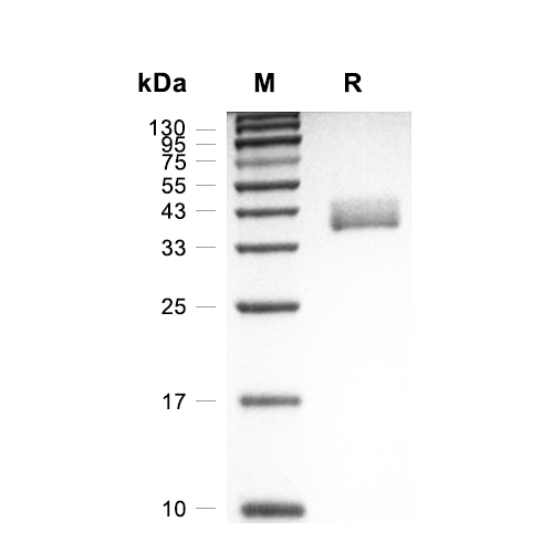 CD52蛋白, Cynomolgus (HEK293, Fc),CD52 Protein, Cynomolgus (HEK293, Fc)