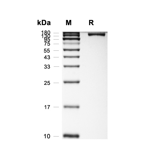 IGSF3蛋白, Human (HEK293, His),IGSF3 Protein, Human (HEK293, His)