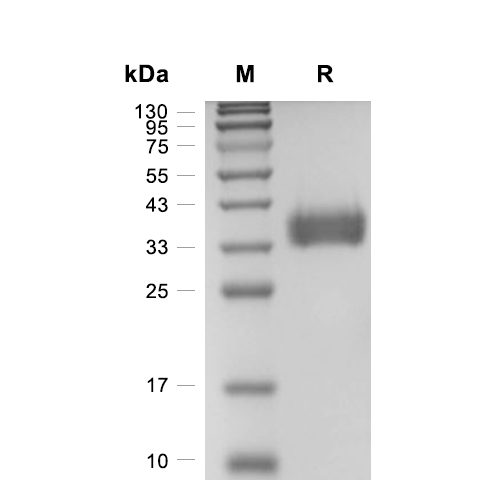 IL-9R蛋白, Rat (HEK293, His),IL-9R Protein, Rat (HEK293, His)
