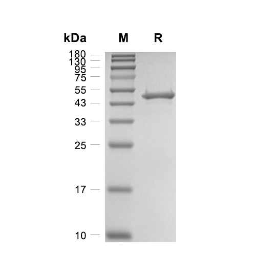 ILKAP/PP2C delta蛋白, Human (HEK293, His),ILKAP/PP2C delta Protein, Human (HEK293, His)