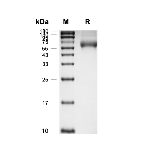 NPTXR蛋白, Human (HEK293, His),NPTXR Protein, Human (HEK293, His)