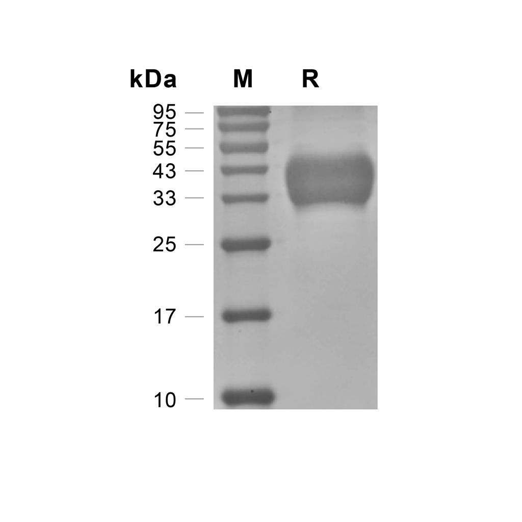 IL-2R beta/CD122蛋白, Rat (HEK293, His),IL-2R beta/CD122 Protein, Rat (HEK293, His)