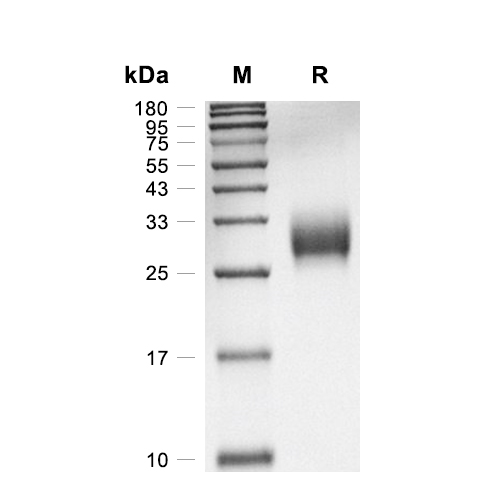 CPLX3蛋白, Human (HEK293, His),CPLX3 Protein, Human (HEK293, His)