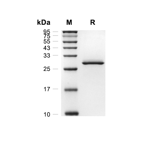 HSD17B14蛋白, Human (HEK293, His),HSD17B14 Protein, Human (HEK293, His)