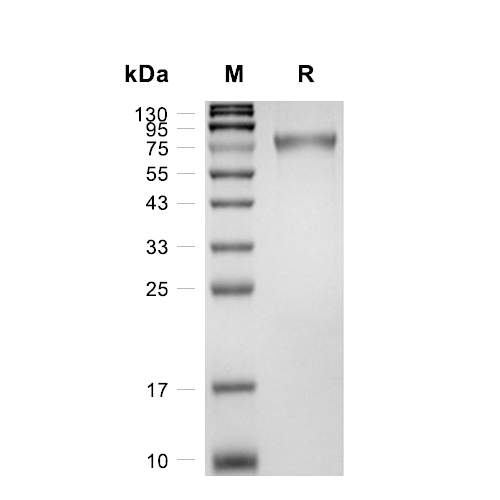 GFRA2/GDNFR-alpha-2蛋白, Mouse (HEK293, His),GFRA2/GDNFR-alpha-2 Protein, Mouse (HEK293, His)