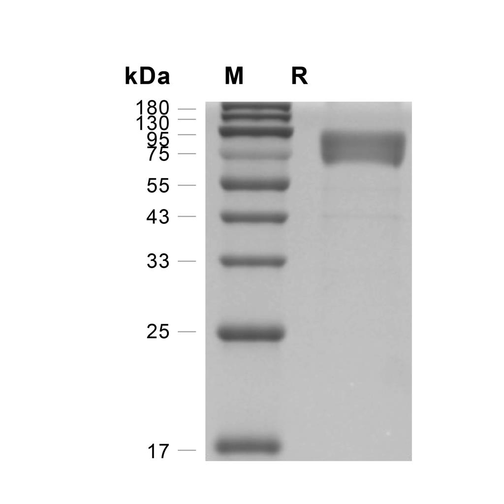 Stomatin/STOM蛋白, Human (HEK293, Fc),Stomatin/STOM Protein, Human (HEK293, Fc)