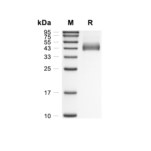 IL-17RB蛋白, Rhesus Macaque (HEK293, His),IL-17RB Protein, Rhesus Macaque (HEK293, His)