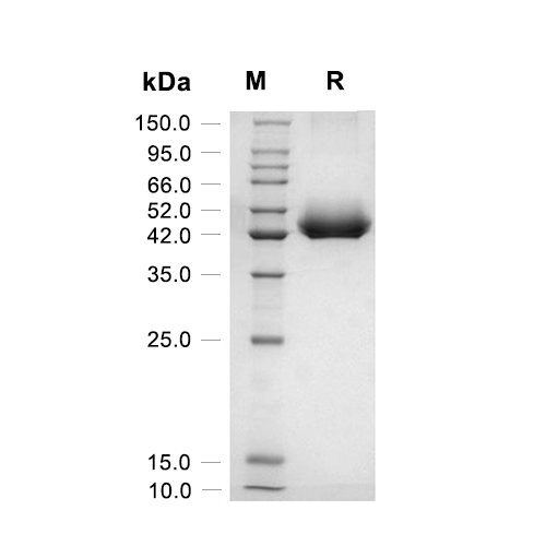 Prostatic acid phosphatase/ACPP蛋白, Human (HEK293, His),Prostatic acid phosphatase/ACPP Protein, Human (HEK293, His)