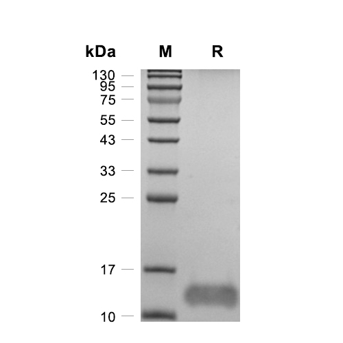 S100A8蛋白, Human (N-His),S100A8 Protein, Human (N-His)