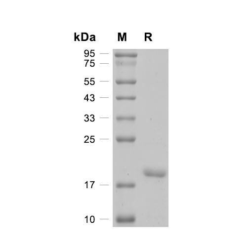 Stathmin蛋白, Human (His),Stathmin Protein, Human (His)