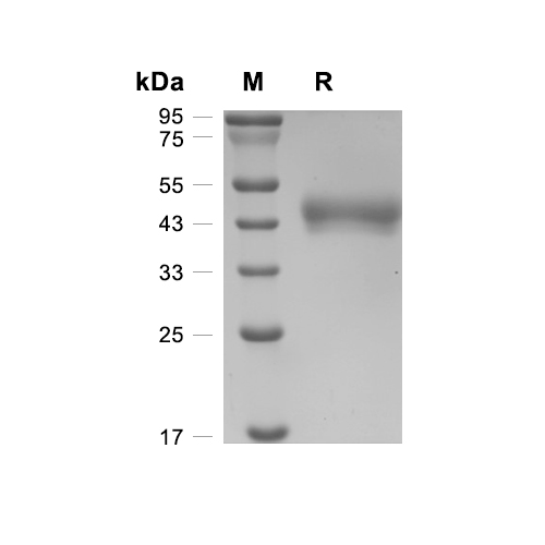 IL-3R alpha/CD123蛋白, Canine (HEK293, His),IL-3R alpha/CD123 Protein, Canine (HEK293, His)