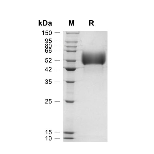 IL-13R alpha 1蛋白, Mouse (HEK293, His),IL-13R alpha 1 Protein, Mouse (HEK293, His)