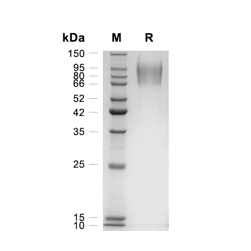 GUCY2C/Guanylyl cyclase C蛋白, Mouse (HEK293, His),GUCY2C/Guanylyl cyclase C Protein, Mouse (HEK293, His)