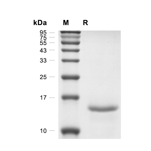 PDGF-BB蛋白, Rat (His),PDGF-BB Protein, Rat (His)