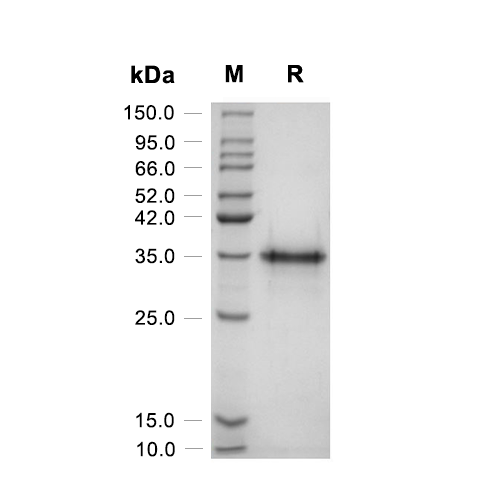 Osteopontin/OPN蛋白, Rat (CHO, His),Osteopontin/OPN Protein, Rat (CHO, His)