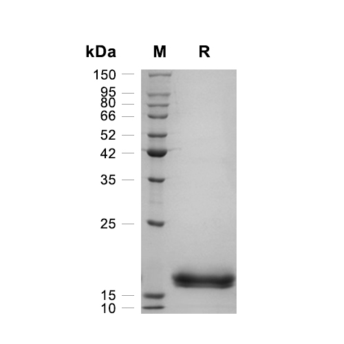 GM-CSF蛋白, Pig,GM-CSF Protein, Pig