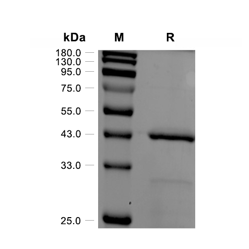 Ataxin-3蛋白, Human (His),Ataxin-3 Protein, Human (His)