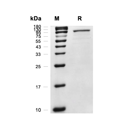 Endo S2蛋白, S. pyogenes (His),Endo S2 Protein, S. pyogenes (His)