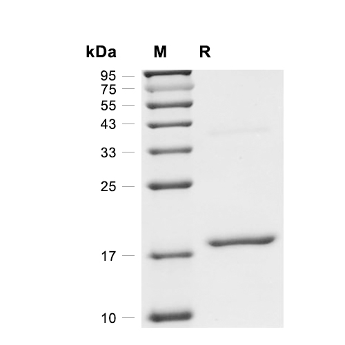 UbcH7/UBE2L3蛋白, Human,UbcH7/UBE2L3 Protein, Human