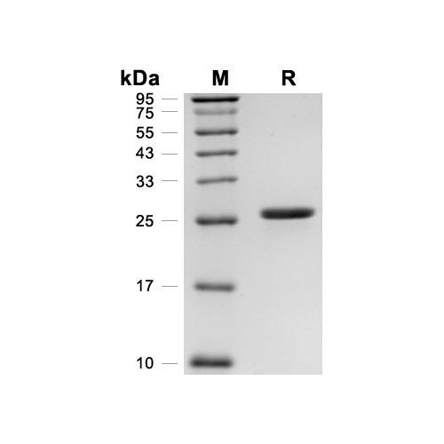 FGF-17蛋白, Human (His),FGF-17 Protein, Human (His)