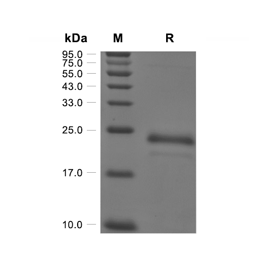 VEGF165蛋白, Human (HEK293, C-His),VEGF165 Protein, Human (HEK293, C-His)