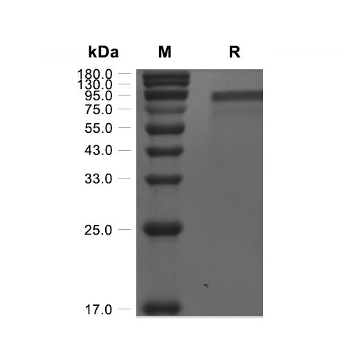 Progranulin/PGRN蛋白, Human (HEK293, C-His),Progranulin/PGRN Protein, Human (HEK293, C-His)