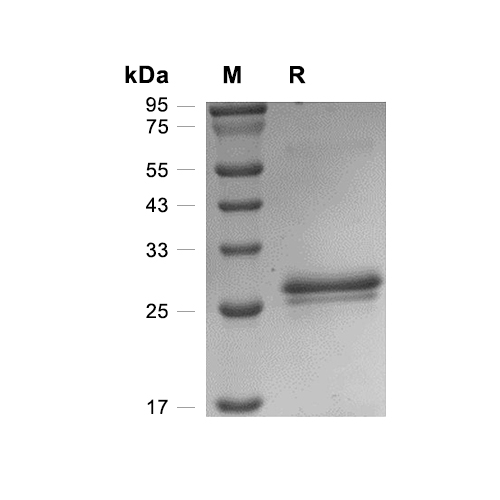 RIZ1蛋白, Human (His),RIZ1 Protein, Human (His)