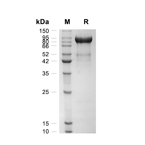 MMP-9蛋白, Human (HEK293, C-His),MMP-9 Protein, Human (HEK293, C-His)