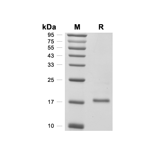 LMW-PTP/ACP1蛋白, Human (C-His),LMW-PTP/ACP1 Protein, Human (C-His)