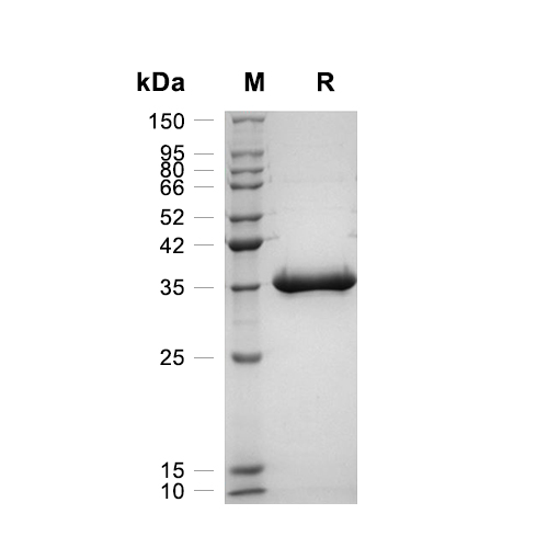 TMEM173蛋白, Human (N-His-Sumo),TMEM173 Protein, Human (N-His-Sumo)