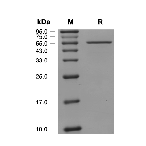 PHGDH蛋白, Human (C-His),PHGDH Protein, Human (C-His)