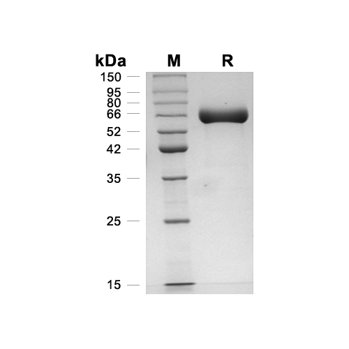 Alkaline Phosphatase/ALPP蛋白, Human (HEK293, C-His),Alkaline Phosphatase/ALPP Protein, Human (HEK293, C-His)