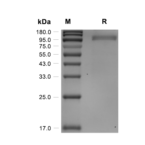 Gliomedin蛋白, Human (HEK293, N-hFc),Gliomedin Protein, Human (HEK293, N-hFc)
