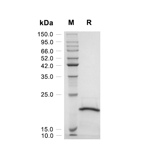 CD20/MS4A1蛋白, Human (Trx-His),CD20/MS4A1 Protein, Human (Trx-His)