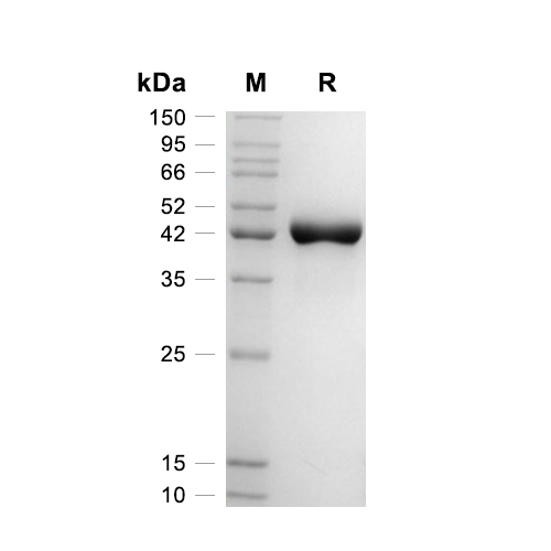 LRPAP1蛋白, Mouse (HEK293, C-His),LRPAP1 Protein, Mouse (HEK293, C-His)