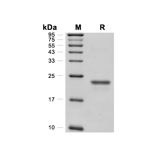 FGF-12蛋白, Human (181a.a, His),FGF-12 Protein, Human (181a.a, His)