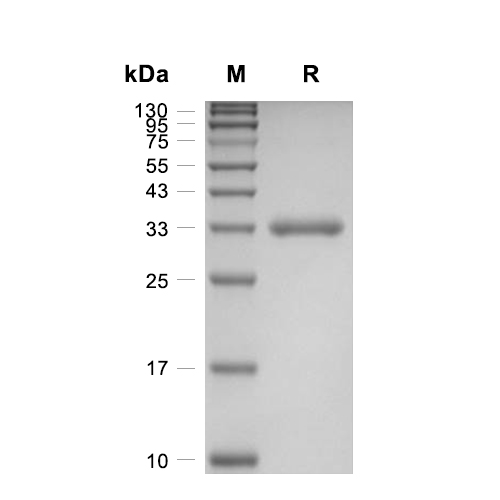RANKL/TNFSF11蛋白, Mouse (HEK293, N-His),RANKL/TNFSF11 Protein, Mouse (HEK293, N-His)